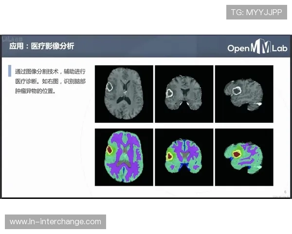 成都乒乓球队包夹战术解析与实战应用探讨